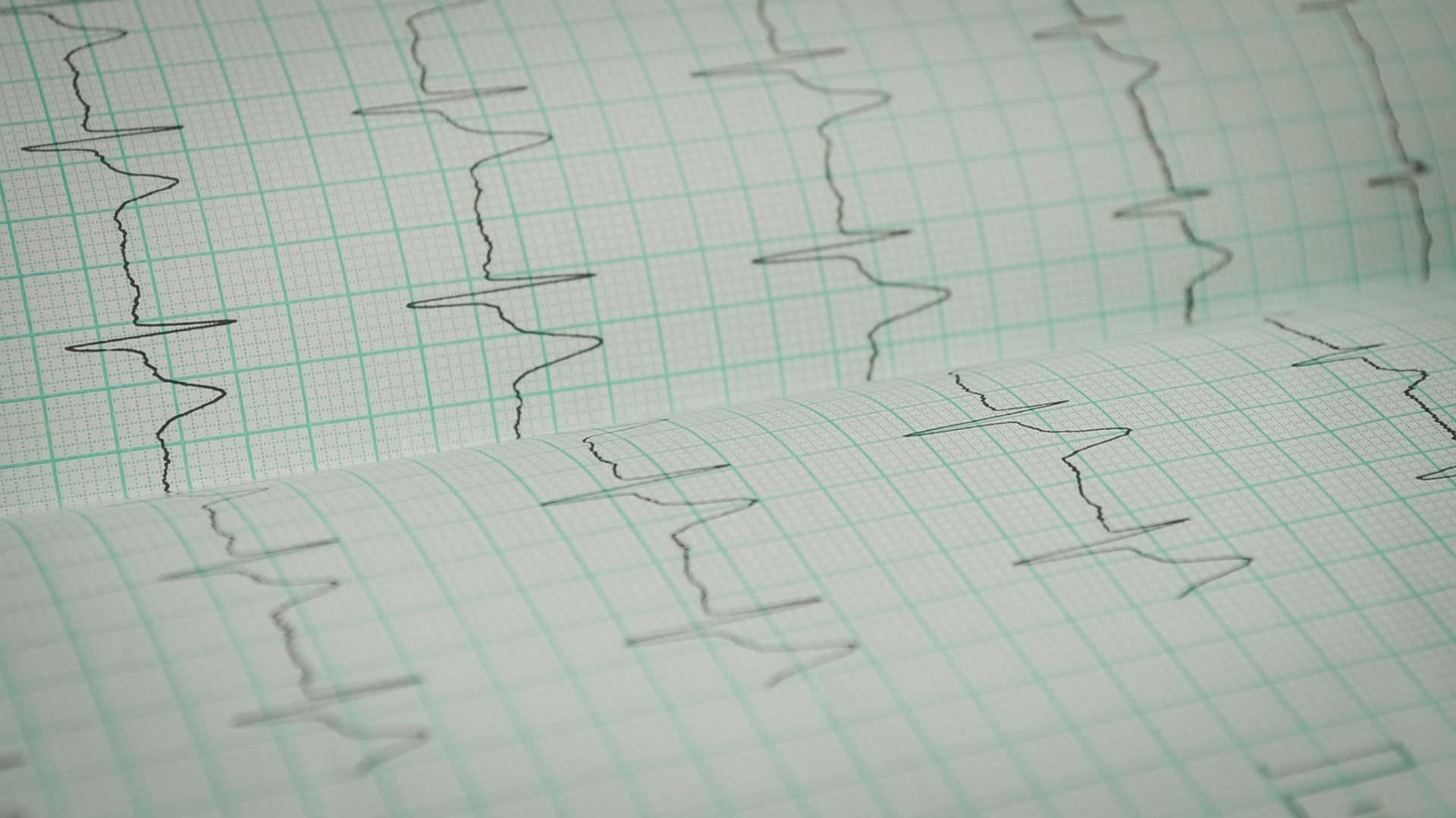 Новосибирцы стали чаще попадать в больницы с инфарктом